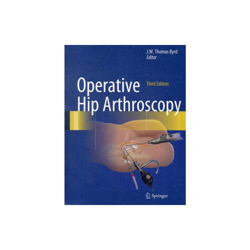 Springer-Verlag New York Inc. Operative Hip Arthroscopy (inbunden, eng)