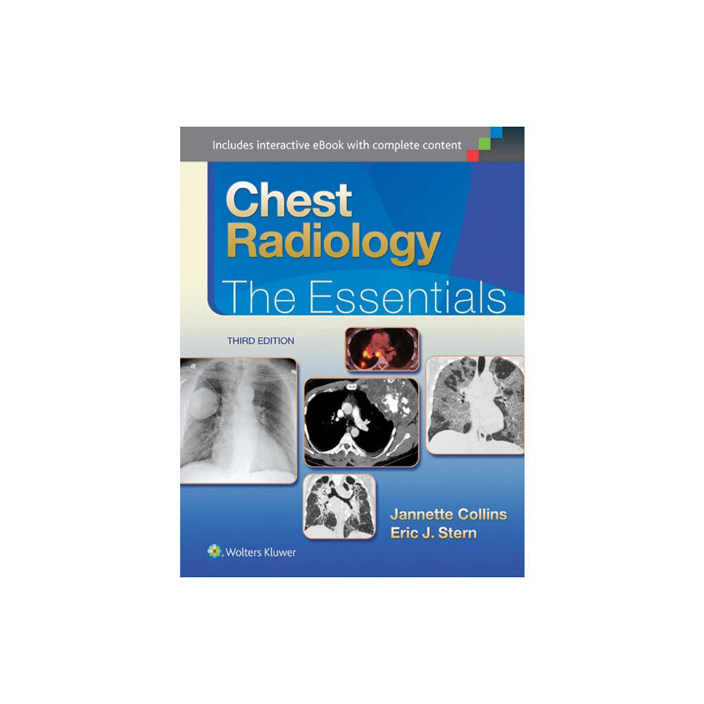 Lippincott Williams and Wilkins Chest Radiology: The Essentials (inbunden, eng)