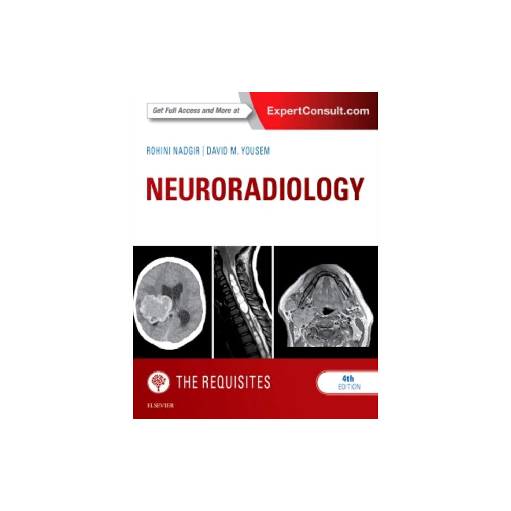 Elsevier - Health Sciences Division Neuroradiology: The Requisites (inbunden)