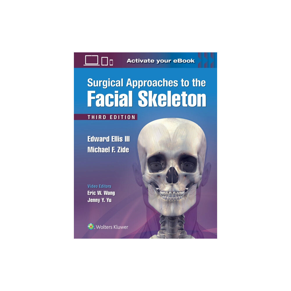 Lippincott Williams and Wilkins Surgical Approaches to the Facial Skeleton (inbunden, eng)