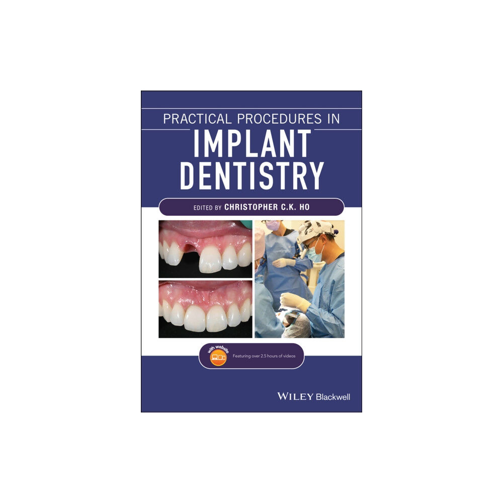 John Wiley And Sons Ltd Practical Procedures in Implant Dentistry (häftad, eng)