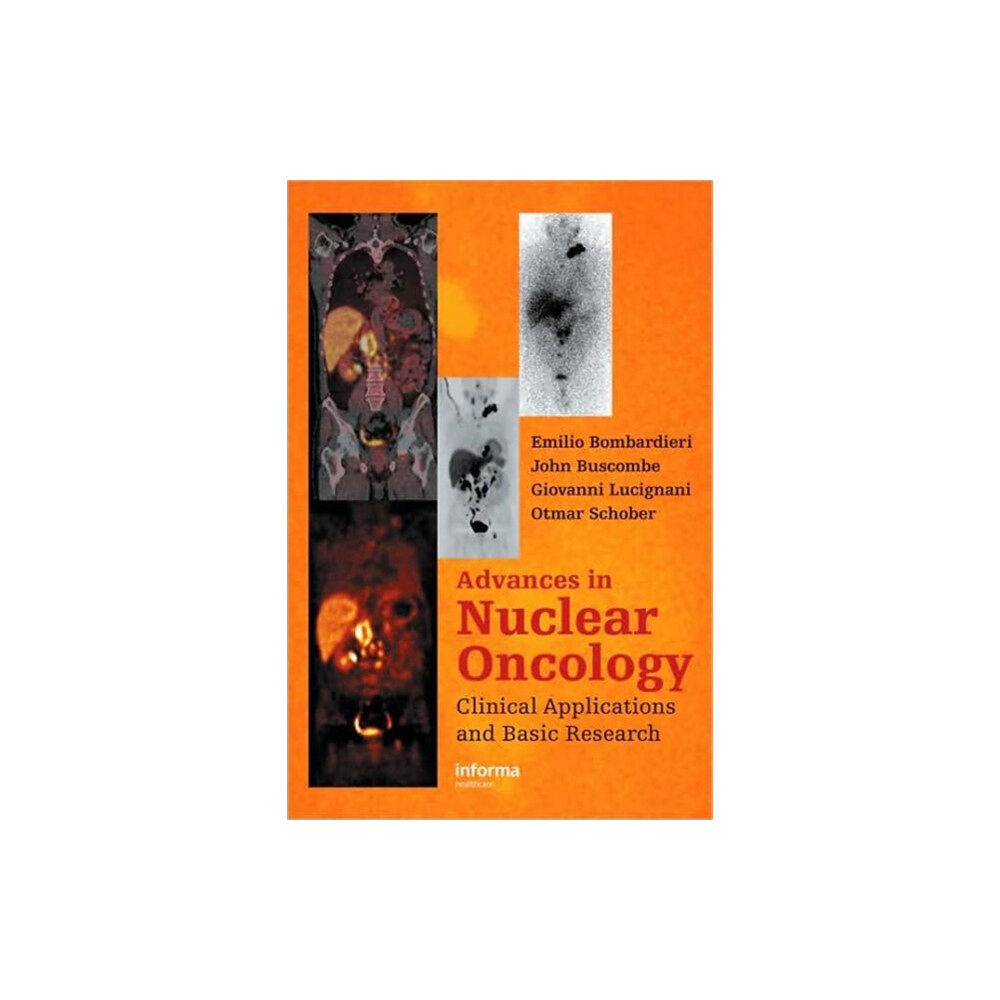 Taylor & francis ltd Advances in Nuclear Oncology (inbunden, eng)