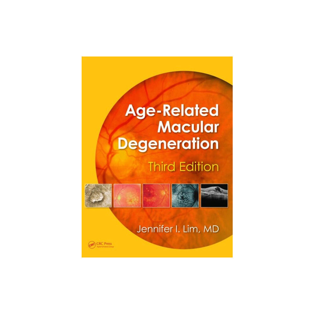 Taylor & francis ltd Age-Related Macular Degeneration (inbunden, eng)