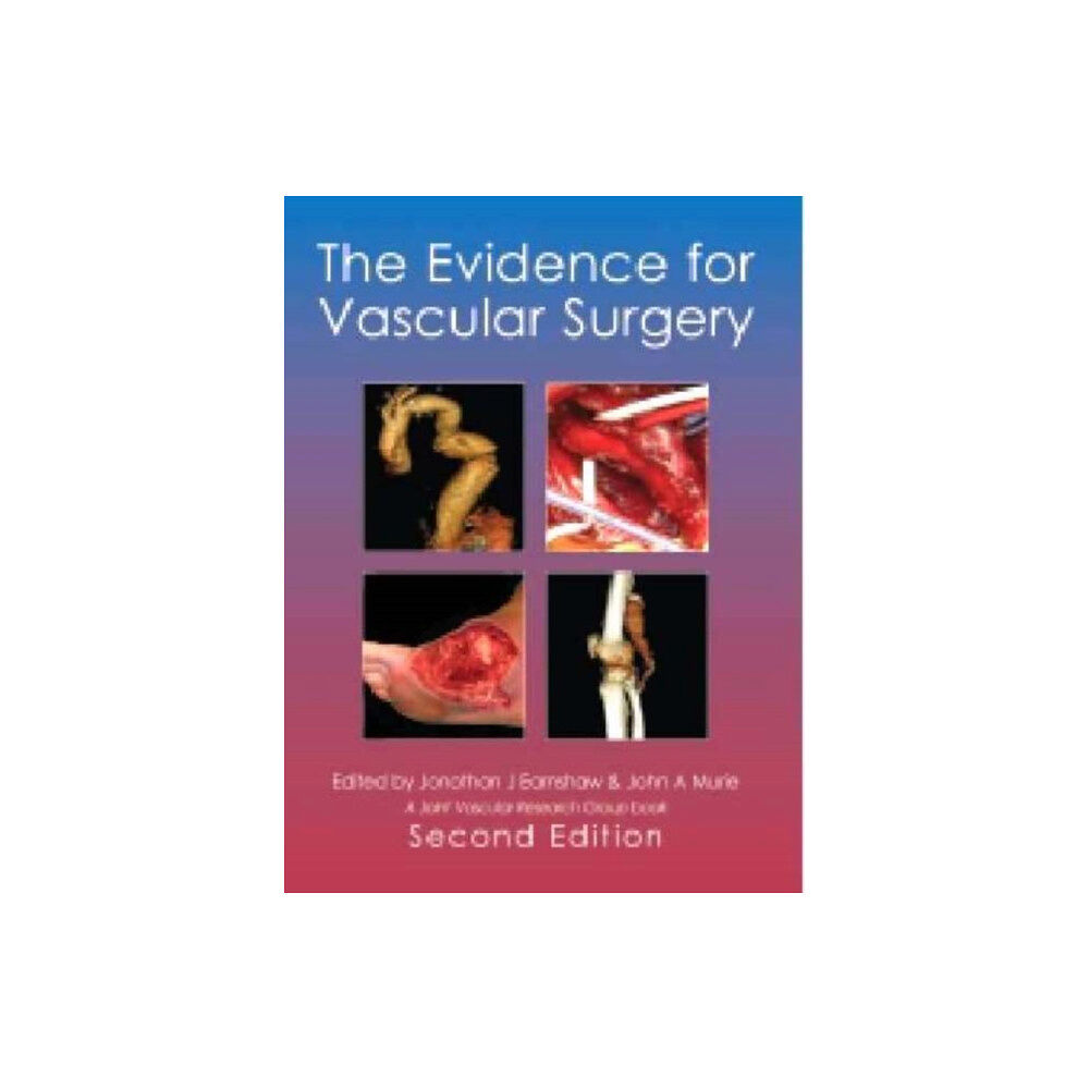 TFM Publishing Ltd The Evidence for Vascular Surgery; second edition (inbunden, eng)