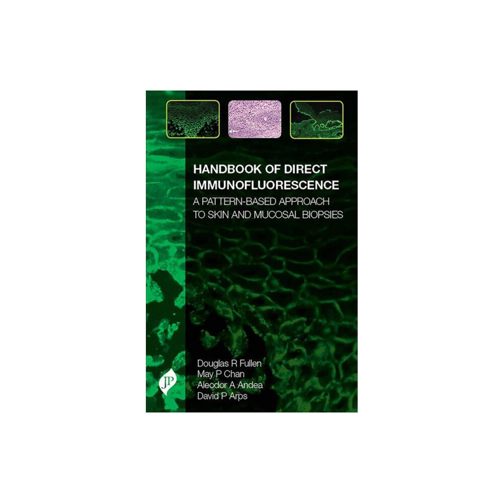 JP Medical Ltd Handbook of Direct Immunofluorescence (inbunden, eng)