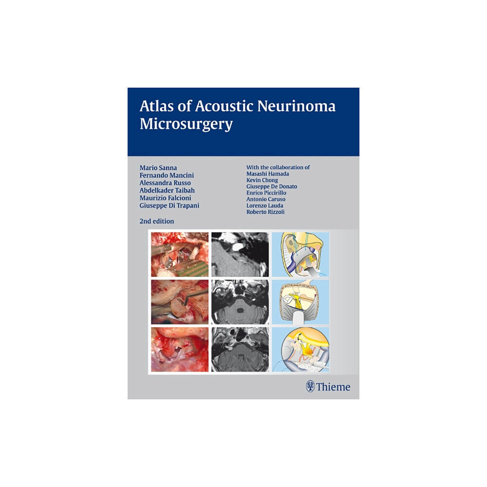 Thieme Publishing Group Atlas of Acoustic Neurinoma Microsurgery (inbunden, eng)