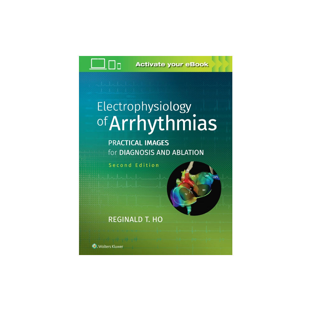 Wolters Kluwer Health Electrophysiology of Arrhythmias (inbunden, eng)