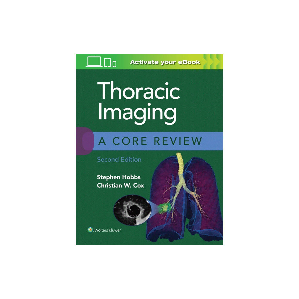 Wolters Kluwer Health Thoracic Imaging: A Core Review (häftad, eng)