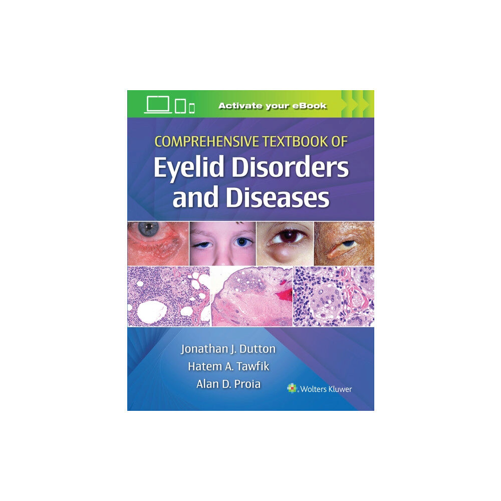 Wolters Kluwer Health Comprehensive Textbook of Eyelid Disorders and Diseases (inbunden, eng)