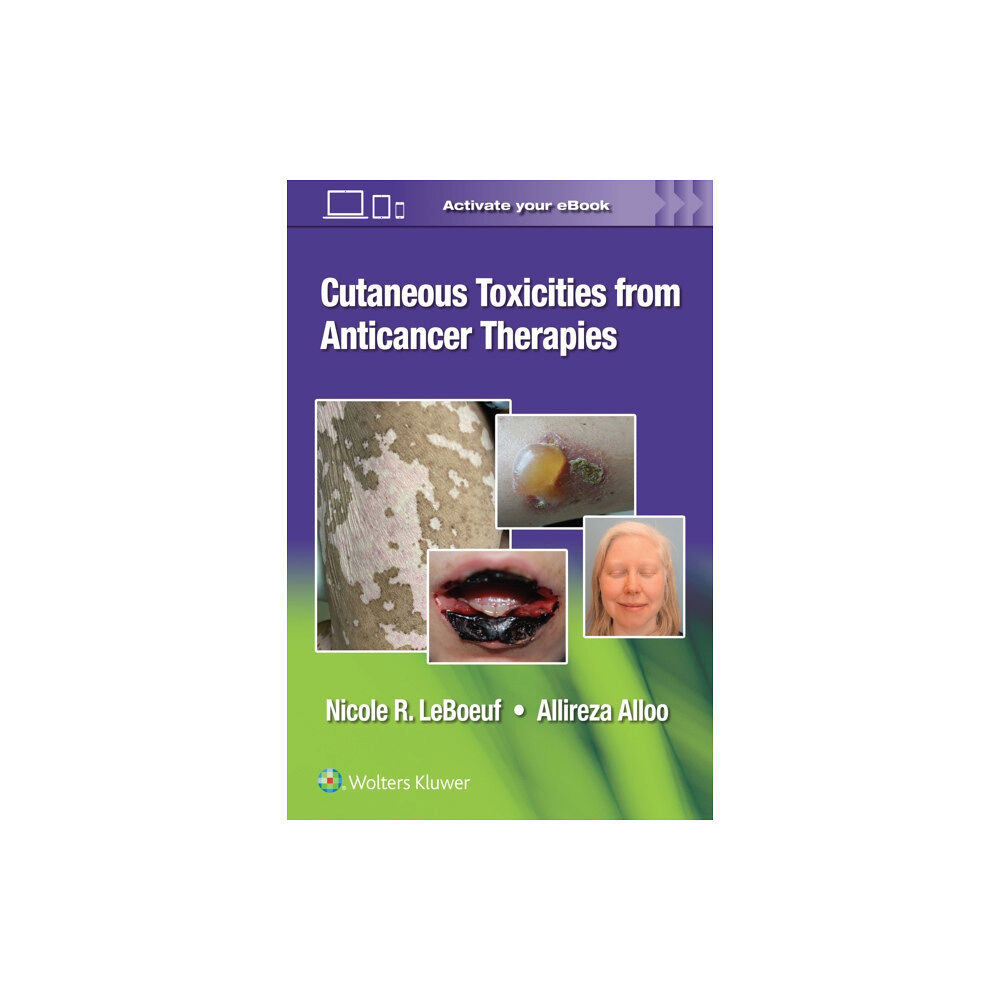 Wolters Kluwer Health Cutaneous Toxicities from Anticancer Therapies (häftad, eng)