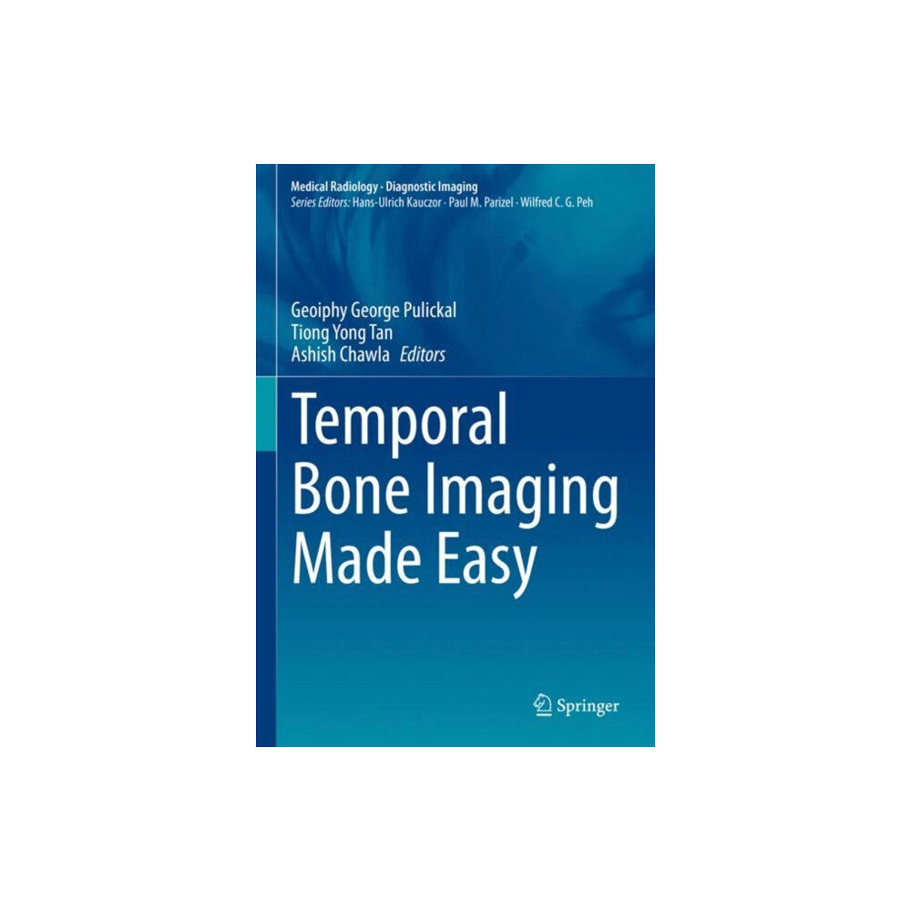 Springer Nature Switzerland AG Temporal Bone Imaging Made Easy (inbunden, eng)