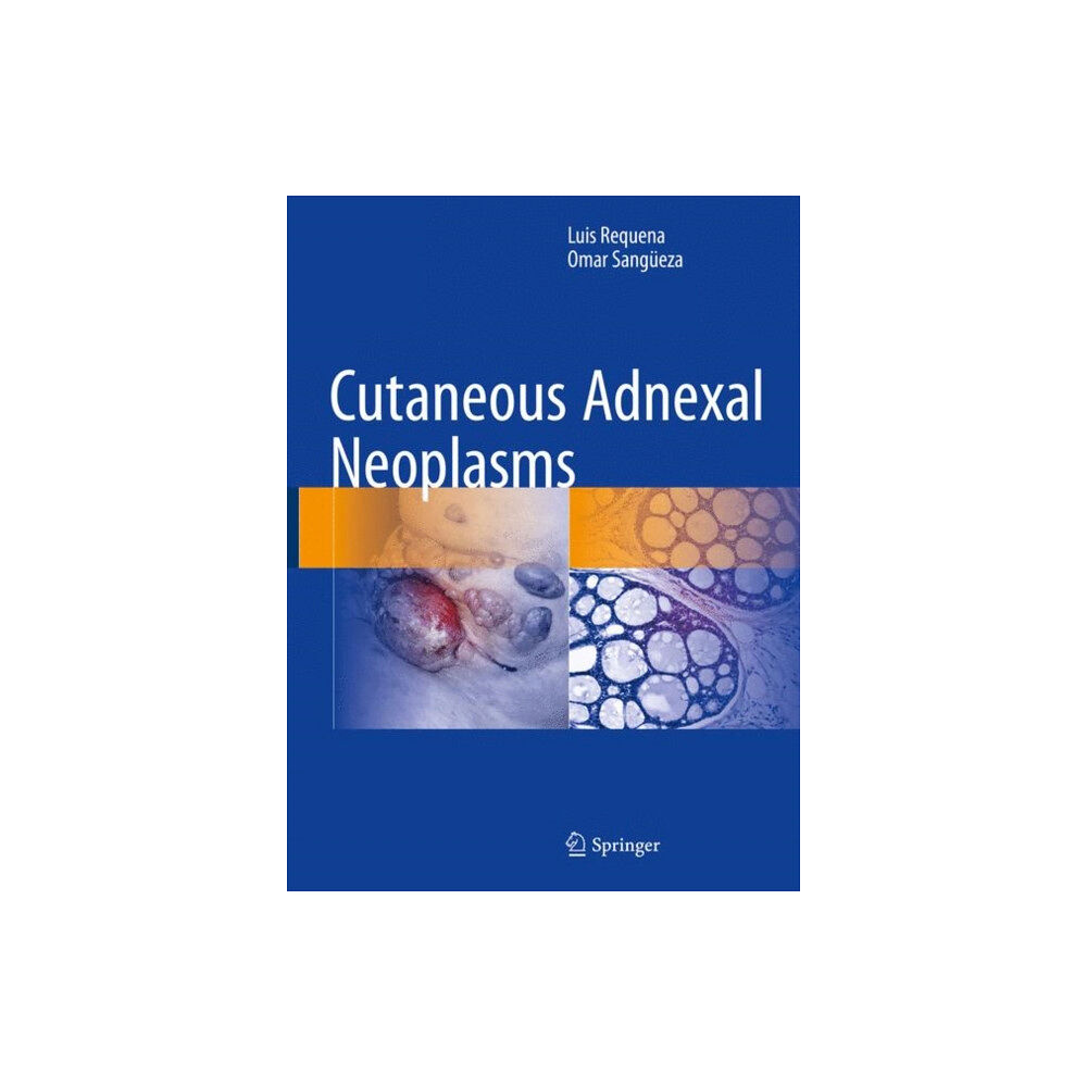 Springer International Publishing AG Cutaneous Adnexal Neoplasms (inbunden, eng)