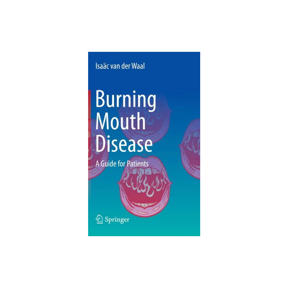 Springer Nature Switzerland AG Burning Mouth Disease (inbunden, eng)