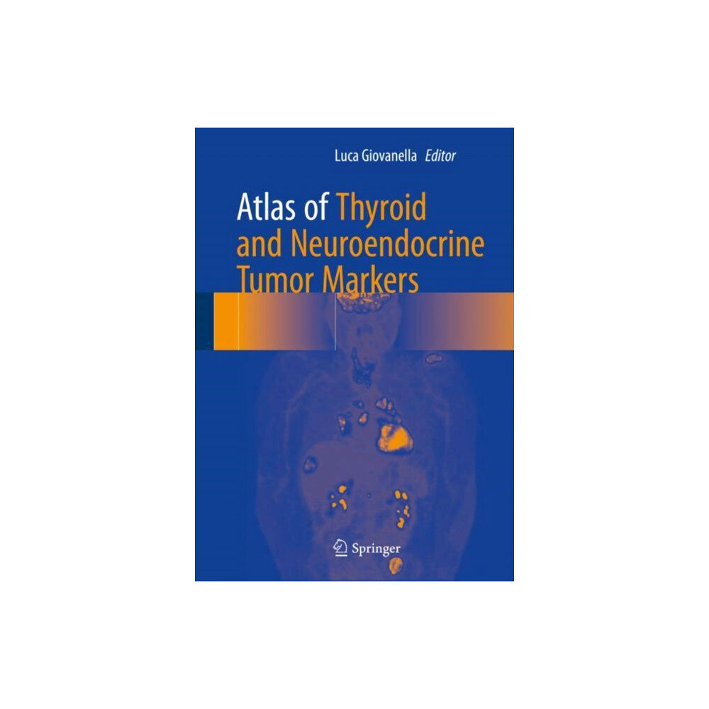 Springer International Publishing AG Atlas of Thyroid and Neuroendocrine Tumor Markers (inbunden, eng)