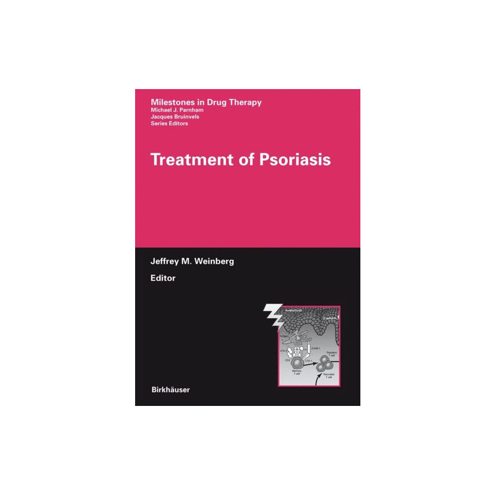 Birkhauser Verlag AG Treatment of Psoriasis (inbunden, eng)