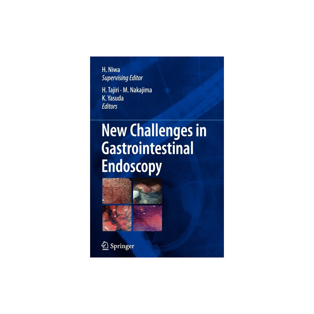 Springer Verlag, Japan New Challenges in Gastrointestinal Endoscopy (häftad, eng)