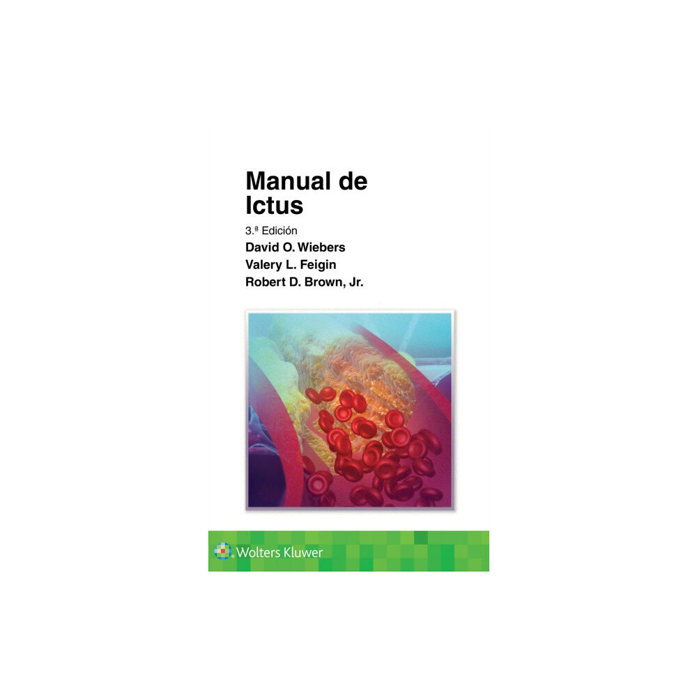 Ovid Technologies Manual de ictus (häftad, spa)