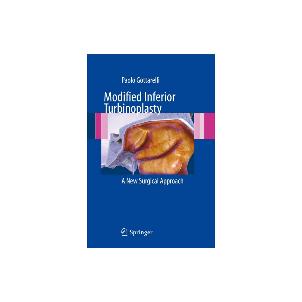 Springer Verlag Modified Inferior Turbinoplasty (häftad, eng)