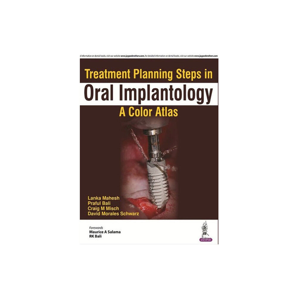 Jaypee Brothers Medical Publishers Treatment Planning Steps in Oral Implantology (häftad, eng)