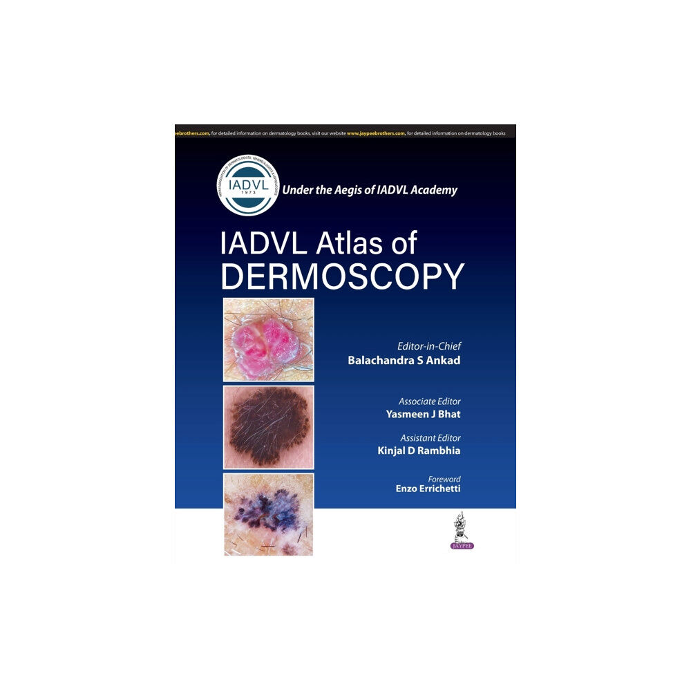 Jaypee Brothers Medical Publishers Atlas of Dermoscopy (häftad, eng)