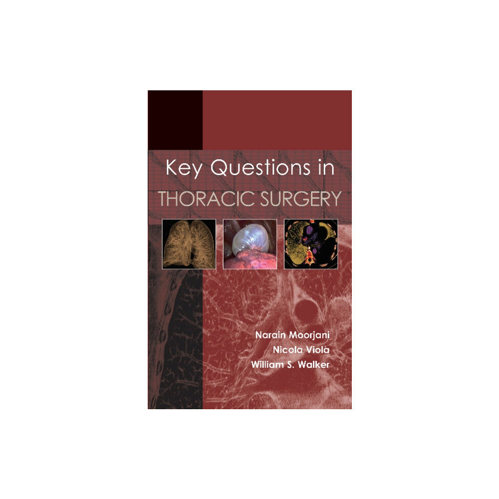 TFM Publishing Ltd Key Questions in Thoracic Surgery (häftad, eng)