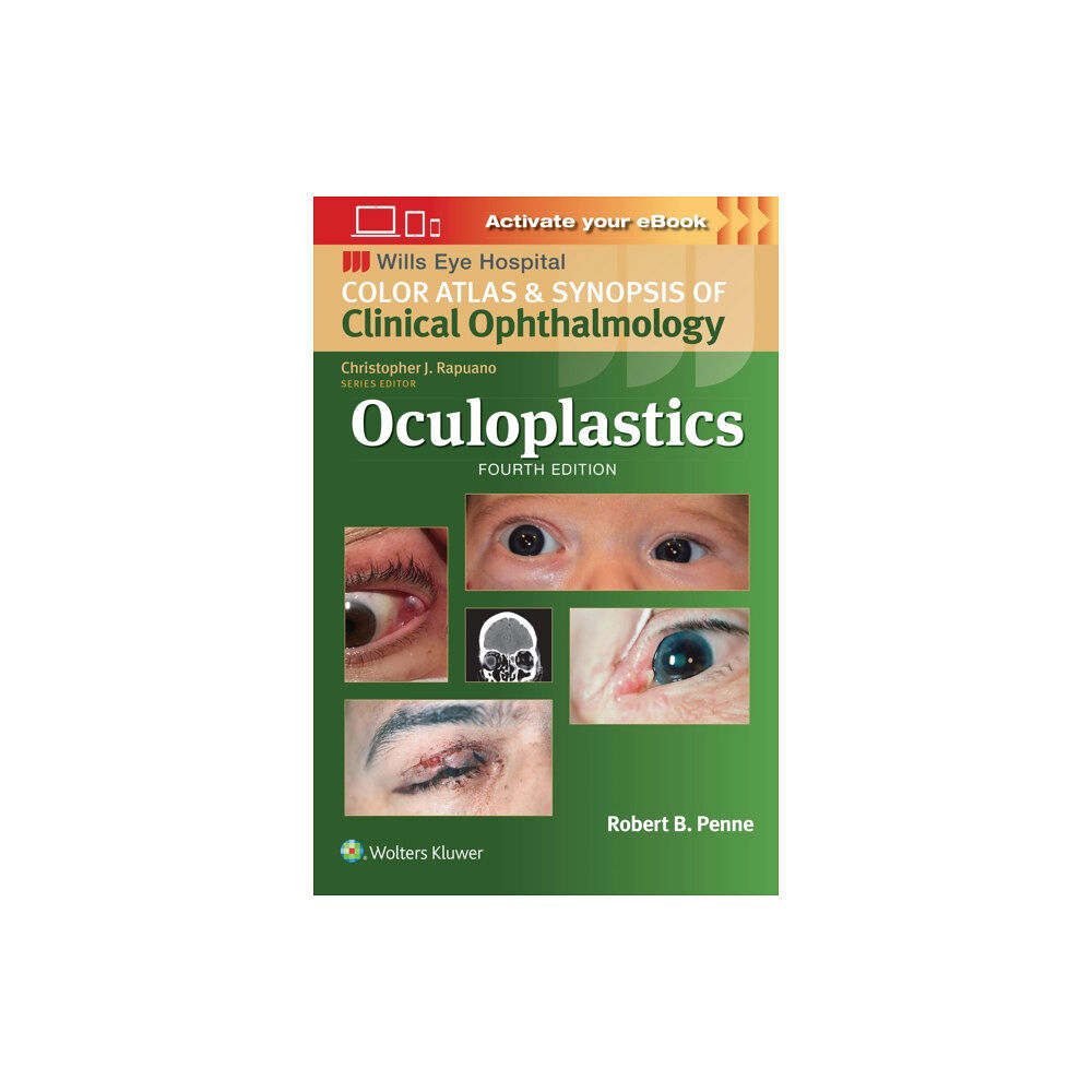 Wolters Kluwer Health Oculoplastics (häftad, eng)