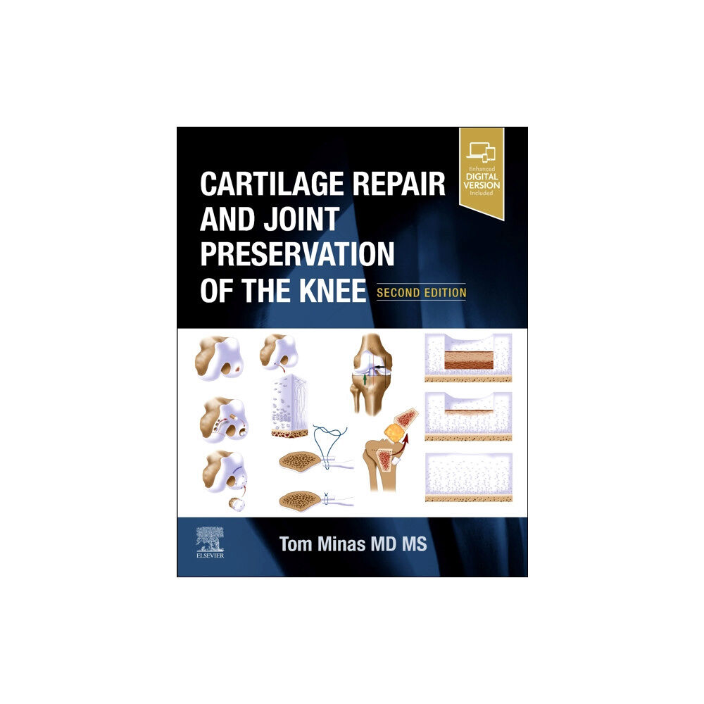 Elsevier - Health Sciences Division Cartilage Repair and Joint Preservation of the Knee (inbunden, eng)