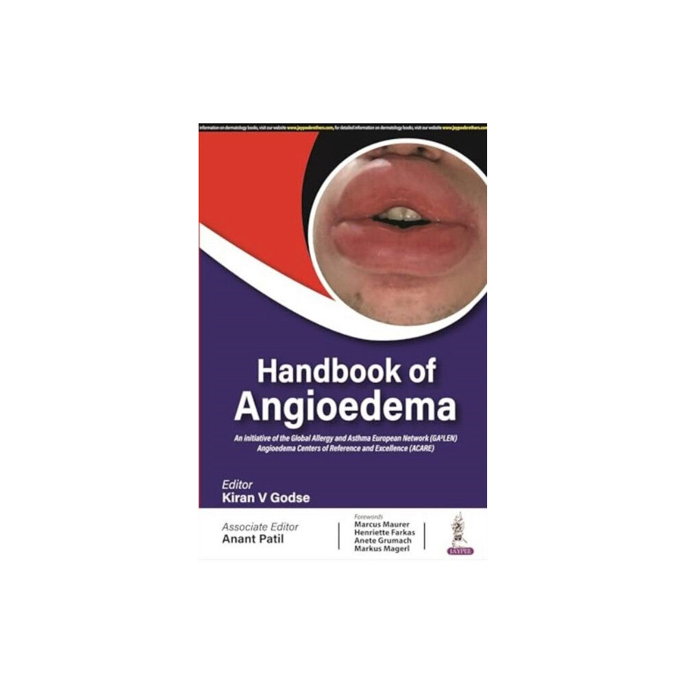 Jaypee Brothers Medical Publishers Handbook of Angioedema (häftad, eng)