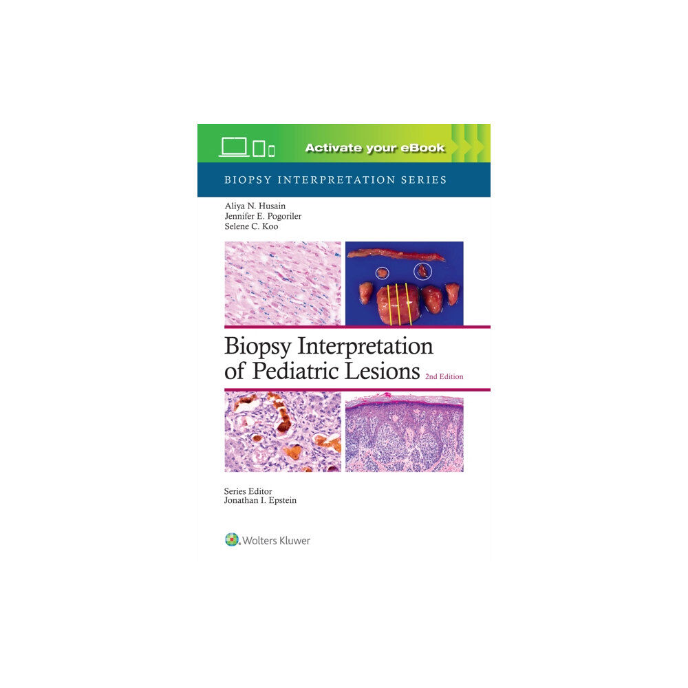 Wolters Kluwer Health Biopsy Interpretation of Pediatric Lesions: Print + eBook with Multimedia (inbunden, eng)