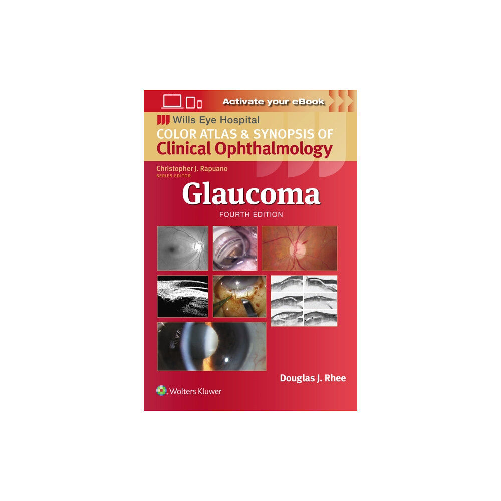 Wolters Kluwer Health Glaucoma (häftad, eng)