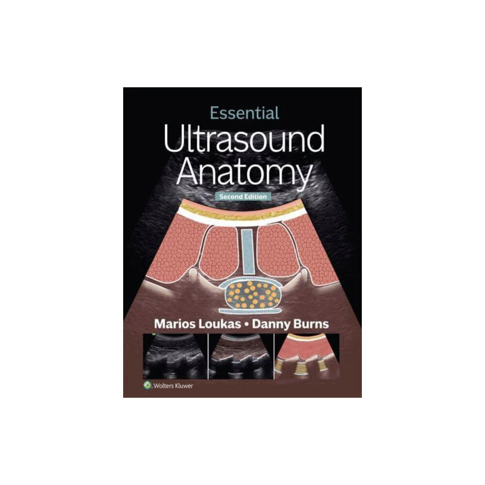 Wolters Kluwer Health Essential Ultrasound Anatomy (häftad, eng)