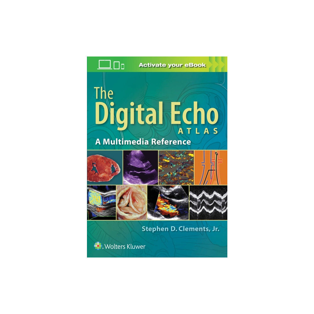 Lippincott Williams and Wilkins The Digital Echo Atlas (inbunden, eng)