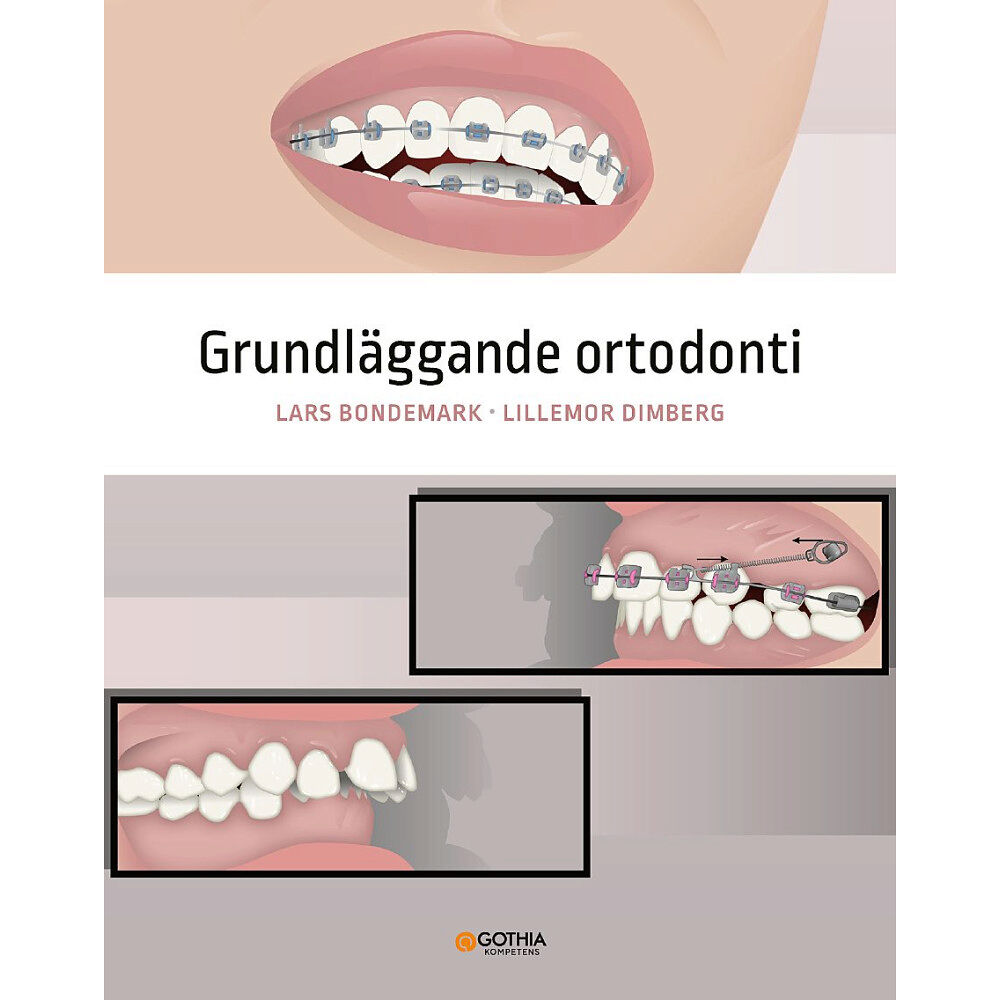 Lillemor Dimberg Grundläggande ortodonti (häftad)