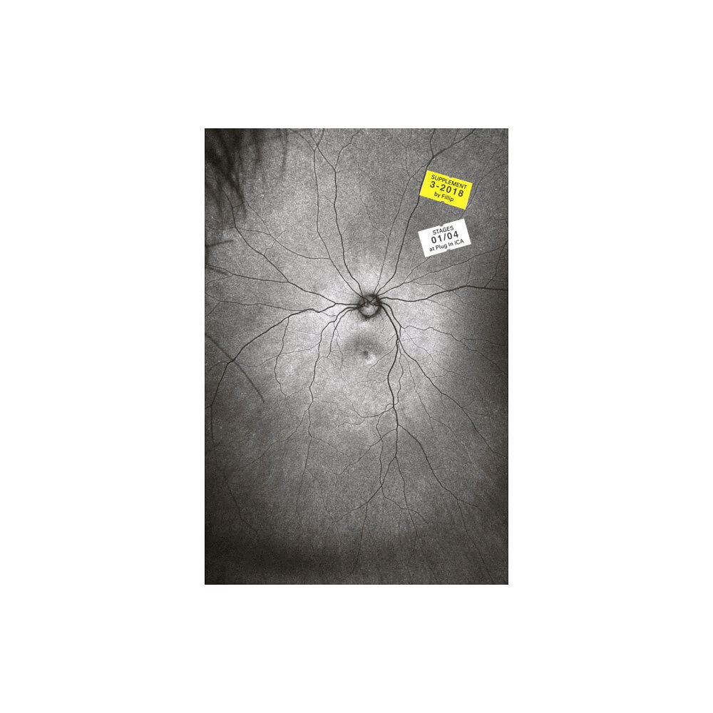 Fillip Supplement 3: The Invention and Conclusion of the Eye (häftad, eng)