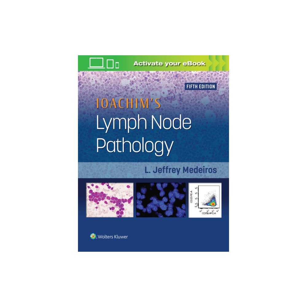 Lippincott Williams and Wilkins Ioachim's Lymph Node Pathology (inbunden, eng)