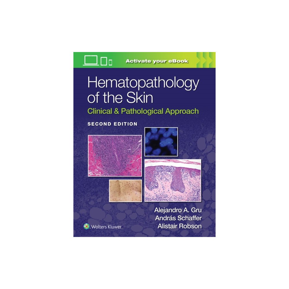Wolters Kluwer Health Hematopathology of the Skin (inbunden, eng)