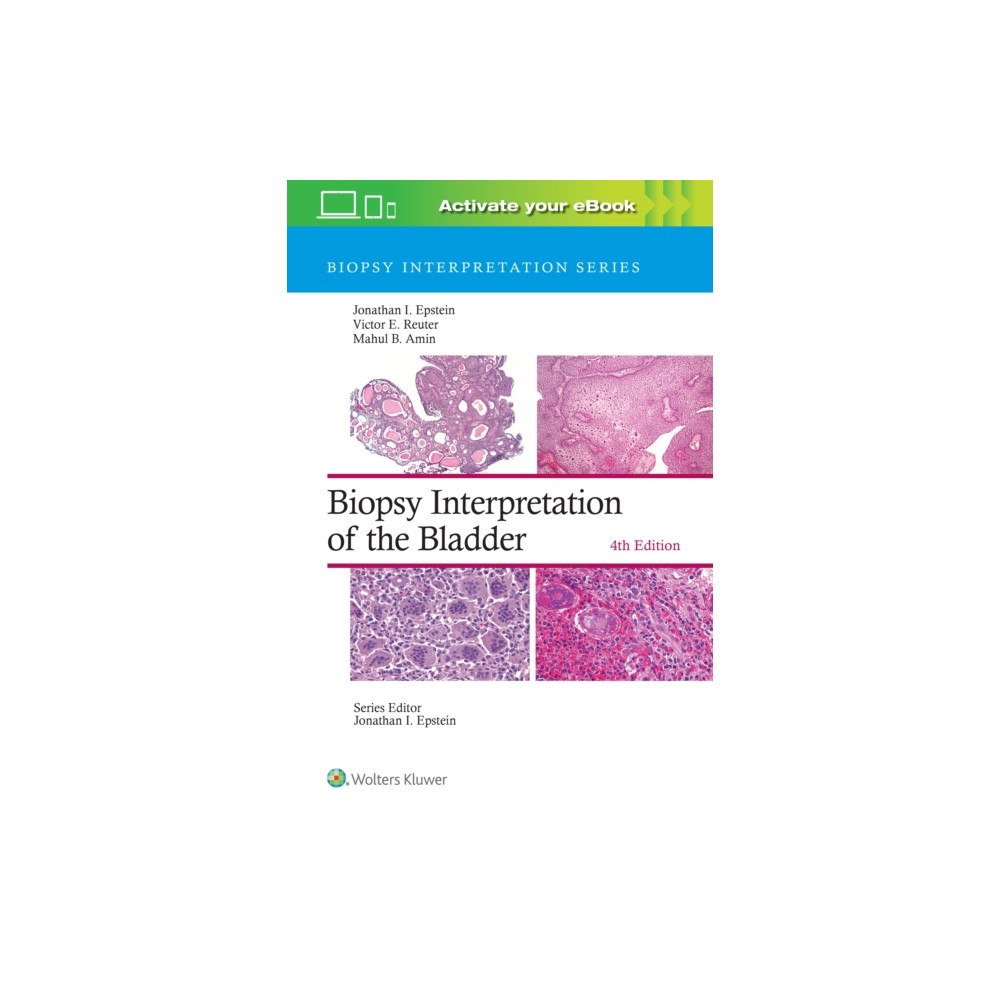 Wolters Kluwer Health Biopsy Interpretation of the Bladder: Print + eBook with Multimedia (inbunden, eng)