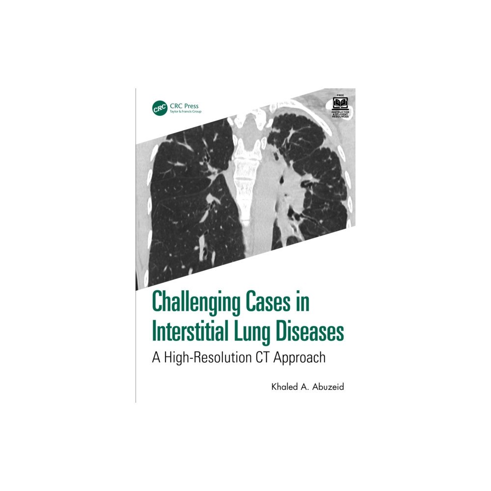 Taylor & francis ltd Challenging Cases in Interstitial Lung Diseases (häftad, eng)