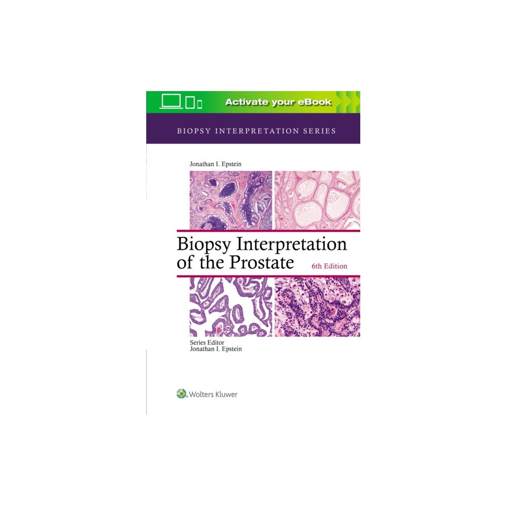 Wolters Kluwer Health Biopsy Interpretation of the Prostate (inbunden, eng)