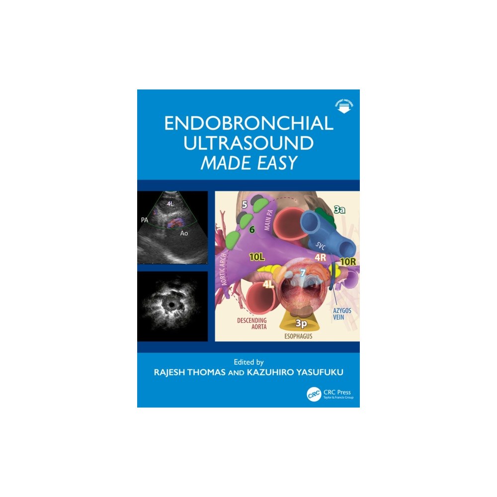 Taylor & francis ltd Endobronchial Ultrasound Made Easy (häftad, eng)