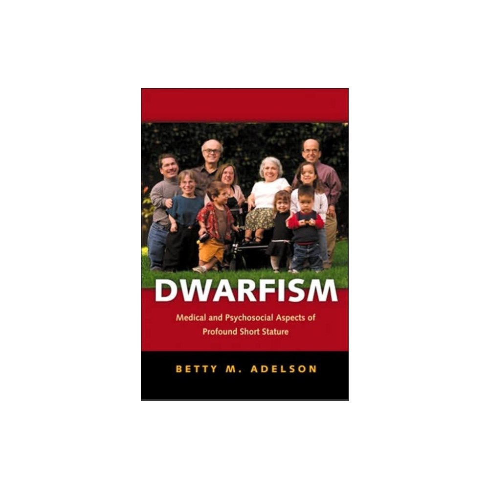 Johns Hopkins University Press Dwarfism (häftad, eng)