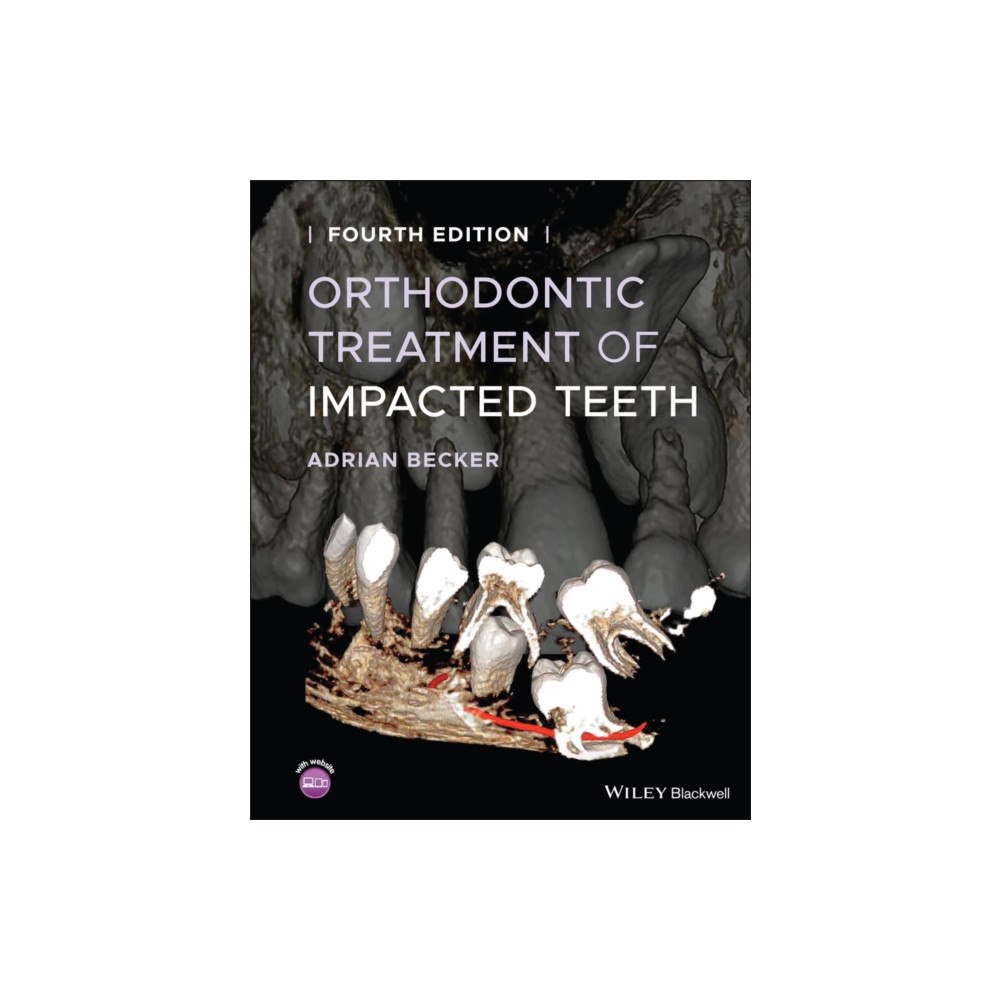John Wiley And Sons Ltd Orthodontic Treatment of Impacted Teeth (inbunden, eng)