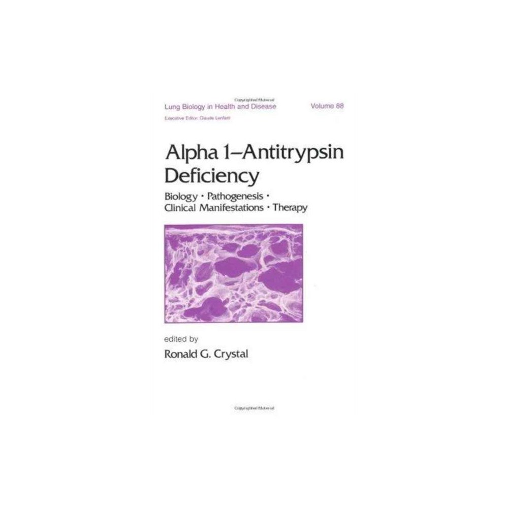Taylor & francis inc Alpha 1 - Antitrypsin Deficiency (inbunden, eng)