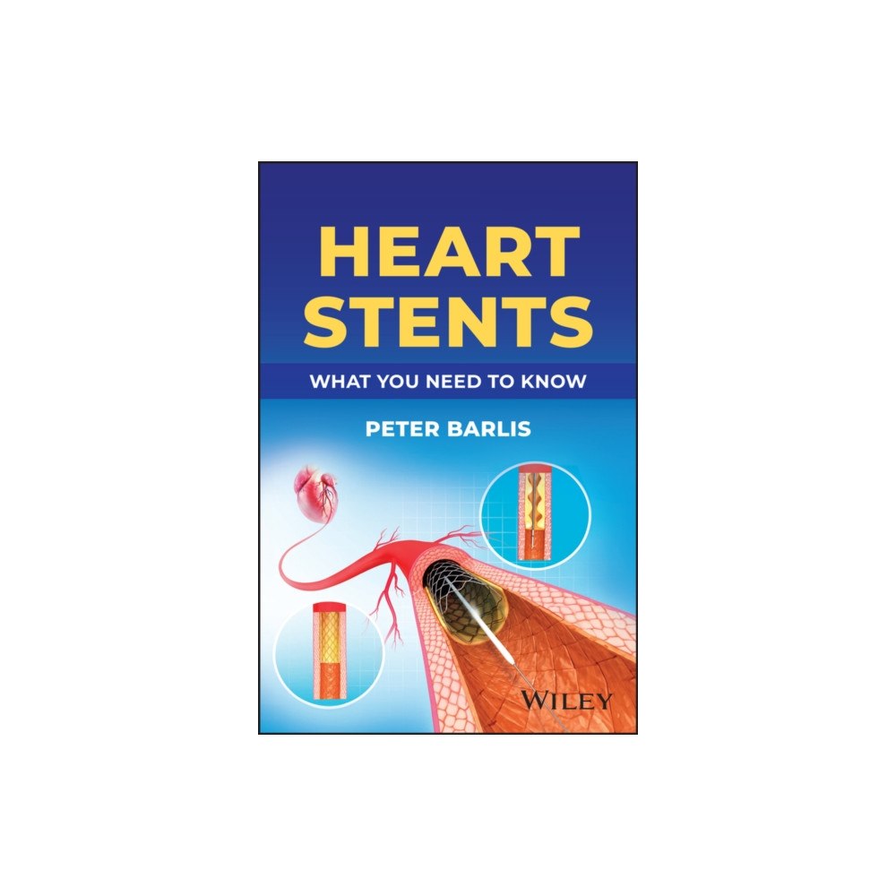 John Wiley & Sons Inc Heart Stents (häftad, eng)