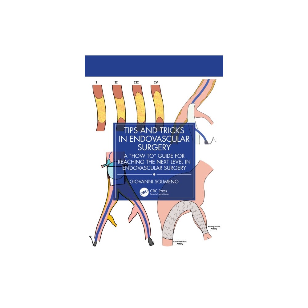 Taylor & francis ltd Tips and Tricks in Endovascular Surgery (häftad, eng)