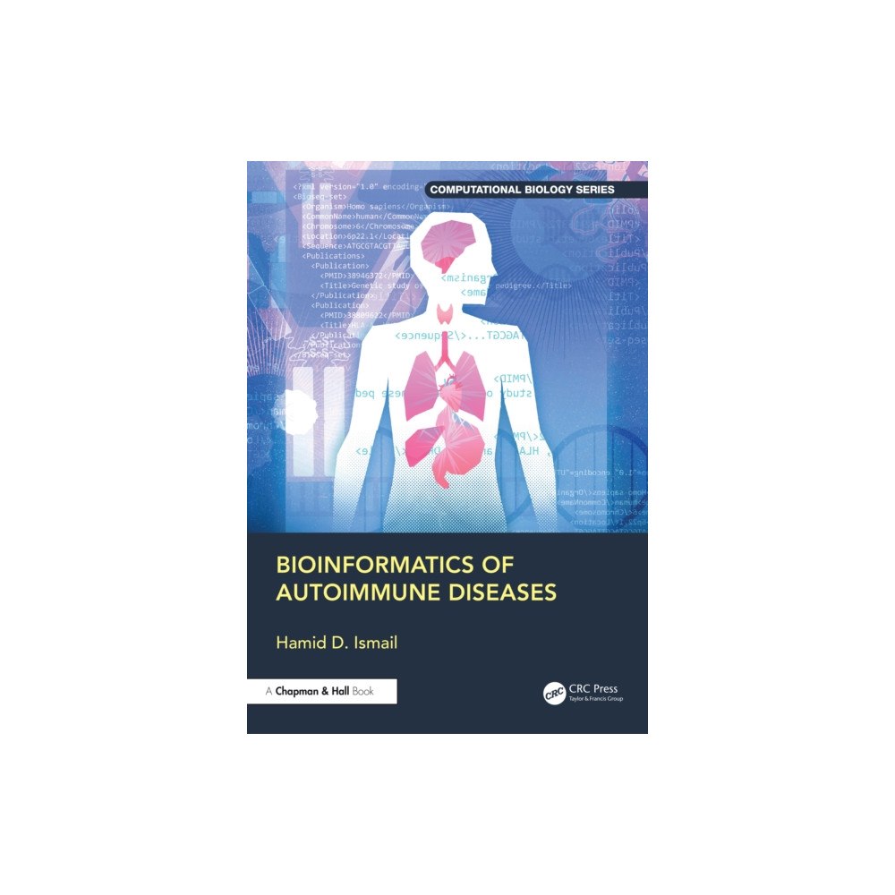 Taylor & francis ltd Bioinformatics of Autoimmune Diseases (häftad, eng)