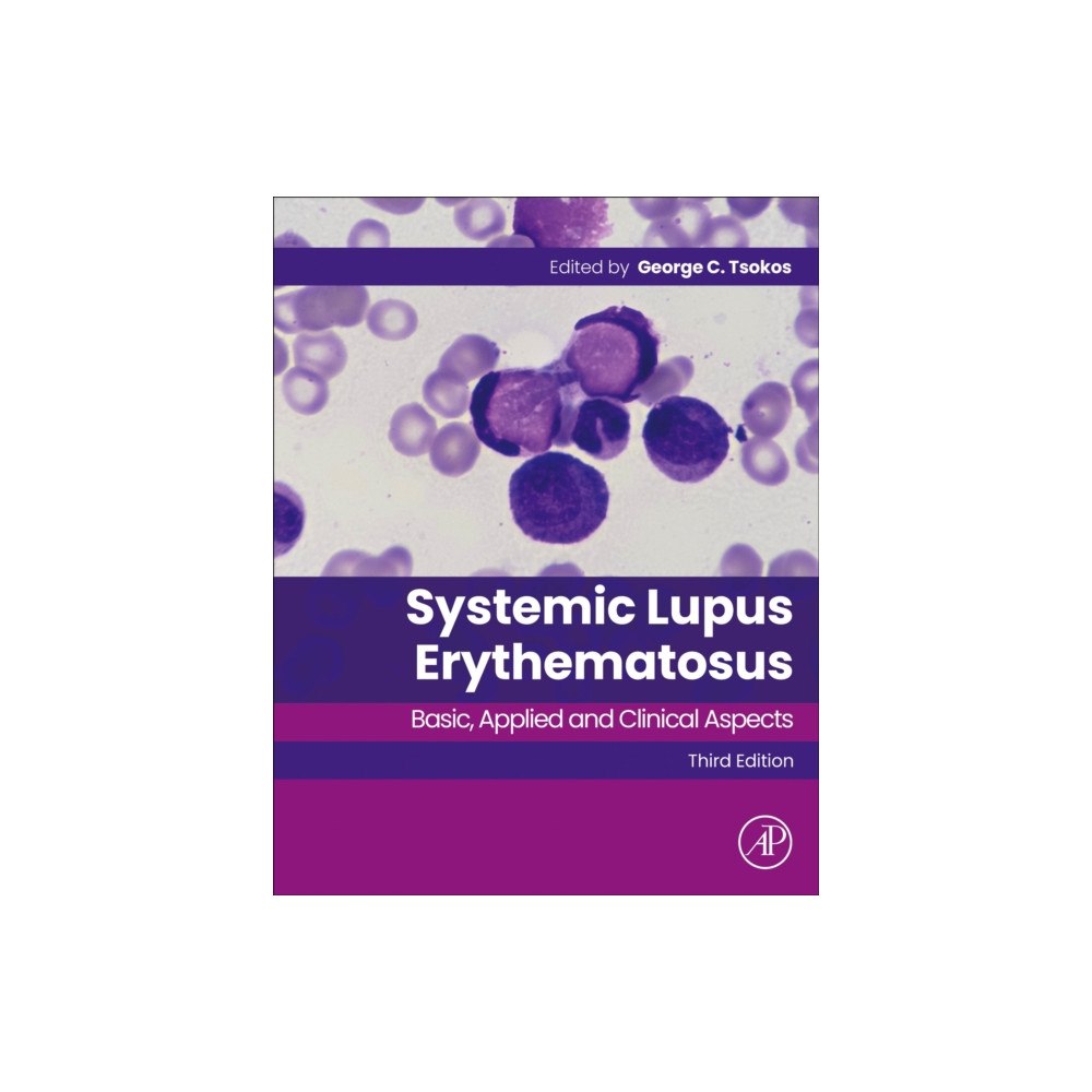 Elsevier Science Publishing Co Inc Systemic Lupus Erythematosus (häftad, eng)