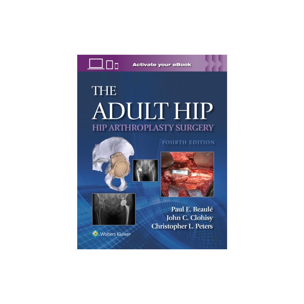 Wolters Kluwer Health The Adult Hip: Hip Arthroplasty Surgery Print + eBook with Multimedia (inbunden, eng)