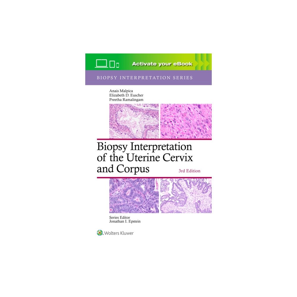 Wolters Kluwer Health Biopsy Interpretation of the Uterine Cervix and Corpus: Print + eBook with Multimedia (inbunden, eng)