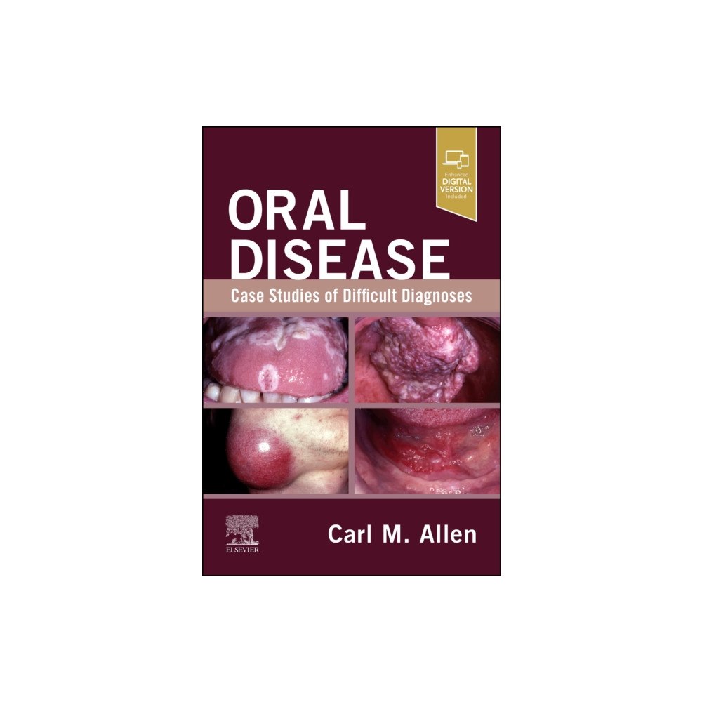 Elsevier Health Sciences Oral Disease: Case Studies of Difficult Diagnoses (häftad, eng)